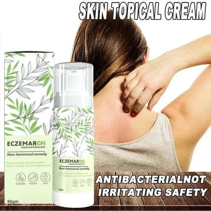 Eczemar + Anti Fungal Spray – Doctor’s Recommended 👨🏽‍⚕️