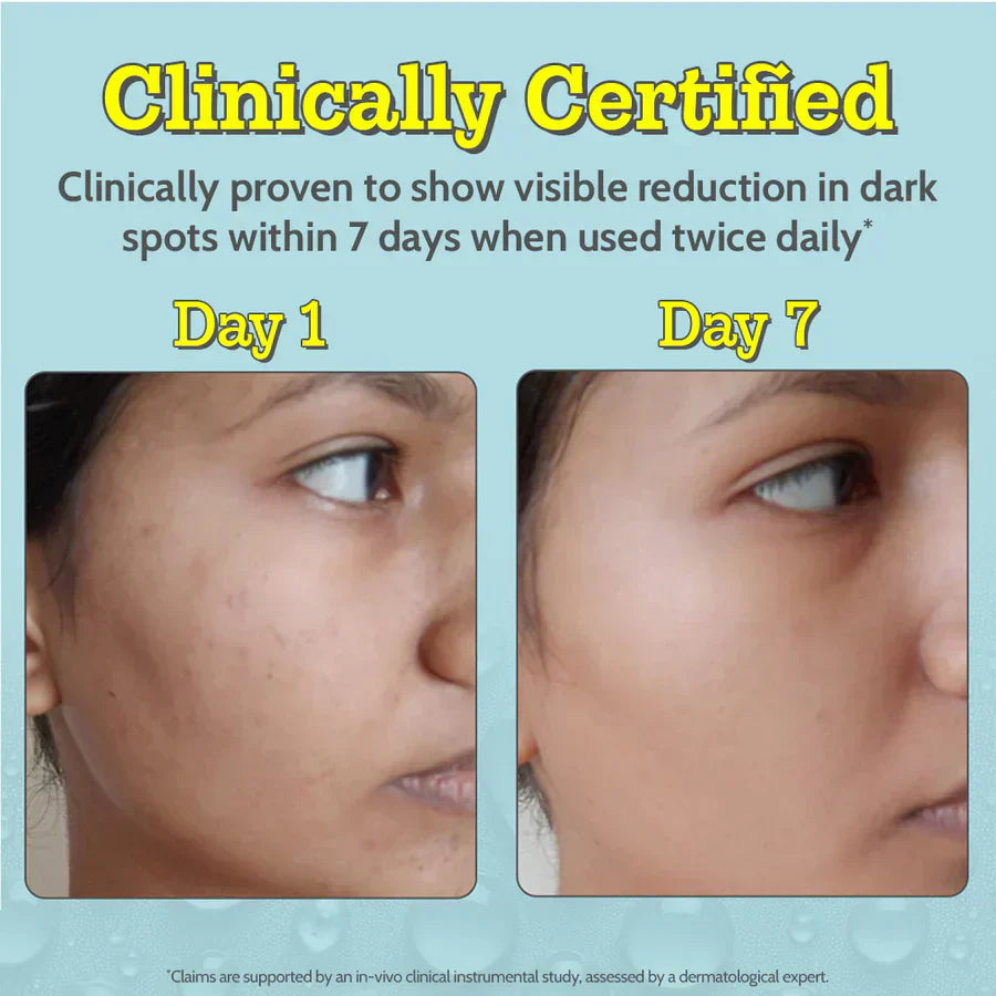 10% Vitamin C Serum for Glowing & Bright Skin