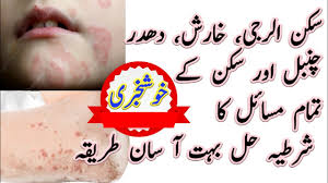 Eczemar + Anti Fungal cream  – Doctor’s Recommended